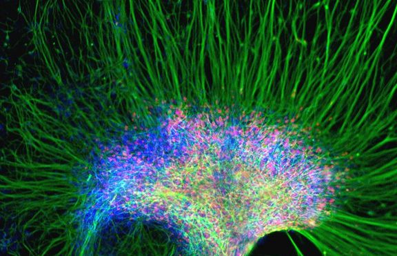 Метод, използващ стволови клетки, спомага за лекуване на Паркинсон