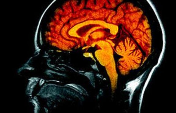 Мозъкът започвал да работи с пълна сила след 60-годишна възраст?