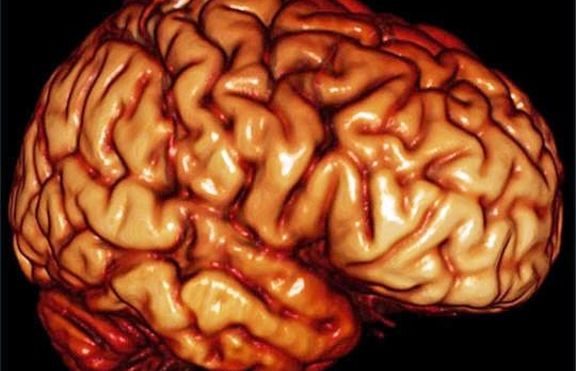 Човешкият мозък  прилича  на мрежата на интернет?