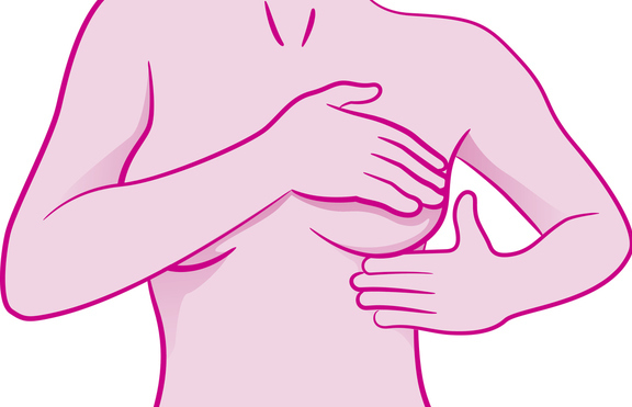 Няколко причини за бучка в гърдите