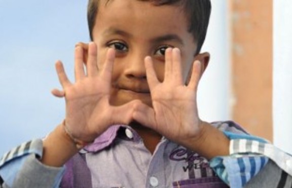 Арпан Саксена е 4-годишно индийче с ... 25 пръста на ръцете и краката