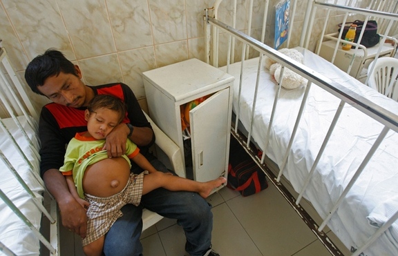 Отстраняват „паразитен близнак” от корема на 3-годишно момче